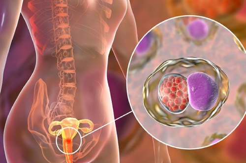 Chữa Viêm Nội Mạc Tử Cung Hết Bao Nhiêu Tiền Pleiku Gia Lai