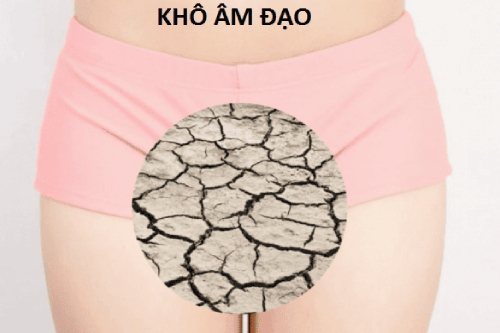 Địa Chỉ Chữa Khô Âm Đạo Nữ Giới Uy Tín Tại Gia Lai
