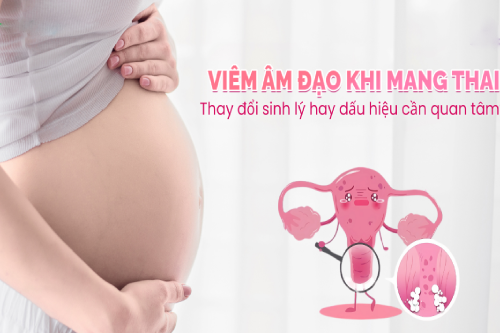 Kinh Nghiệm Xử Lý Nấm Âm Đạo Khi Mang Thai Pleiku Gia Lai Kinh Nghiệm Xử Lý Nấm Âm Đạo Khi Mang Thai Pleiku Gia Lai