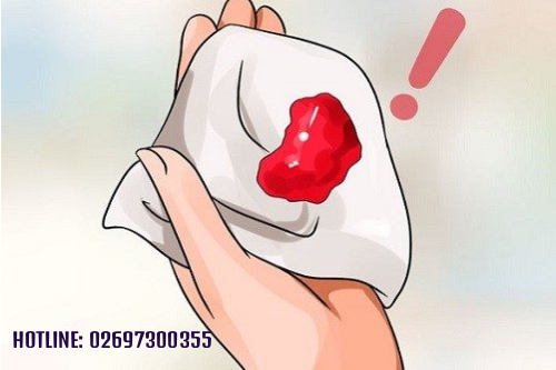 Máu Kinh Màu Đỏ Tươi là Tình Trạng Gì Gia Lai? Máu Kinh Màu Đỏ Tươi là Tình Trạng Gì Gia Lai?