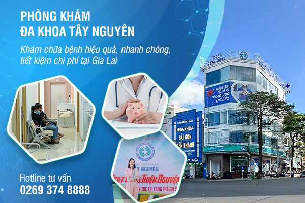 Địa chỉ thăm khám phụ khoa uy tín Phòng Khám Đa Khoa Tây Nguyên