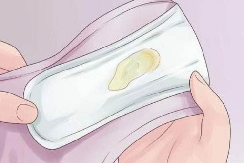 Tìm Hiểu Nguyên Nhân Huyết Trắng Có Mùi Hôi