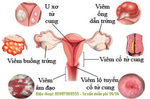 Tư Vấn Phụ Khoa Miễn Phí 24/7 – Giải Pháp An Toàn Cho Sức Khỏe Nữ Giới Gia Lai